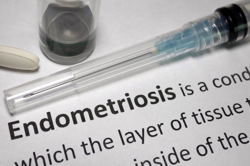 Endometriosis