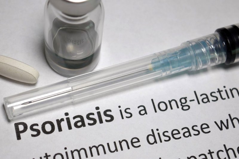 psoriasis